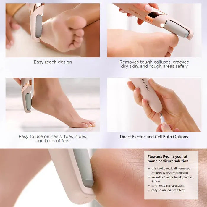 Flawless Pedi Rechargeable Electric Foot File – Gentle Callus & Dead Skin Remover for Smooth Feet